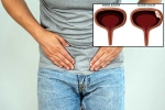 Bladder Cancer reasons, Bladder Cancer, why is bladder cancer common in men, Bladder cancer