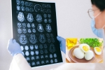 Eggs and Alzheimer’s study, Eggs and Alzheimer’s tips, eggs may help prevent alzheimer s study, E coli