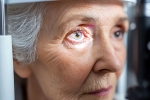 Glaucoma breaking, Glaucoma health experts, all about the eye disease glaucoma, Treatment
