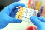 CSIR, genome, everything about feluda a low cost covid 19 test in india, Cgi