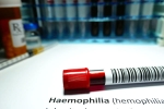 Hemophilia among men, Hemophilia research, why are men likely to develop hemophilia, Female