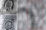 coronavirus, coronavirus, indian scientists reveal images of the novel coronavirus under a microscope, Indian scientist