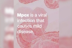 mpox cases, mpox mortality rate, mpox emergency again, Safe sex