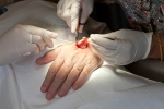 skin cancer treatment, skin cancer types, cancer treatment can now be pain free, American chemical society