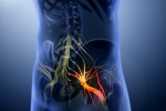 Sciatica nerve, Sciatica nerve, help yourself on sciatica, Pinched nerve