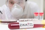 Zika Virus, US blood centers, fda expands zika screening to all us blood centers, Zika virus