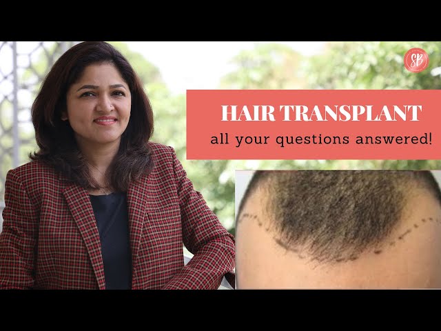 Best Hair Transplant in Gurgaon